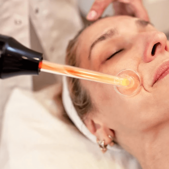 Hochfrequenz‑Glättungsgerät mit 4 Aufsätzen – Akne‑ & Anti‑Aging‑Therapie & Haarstimulation